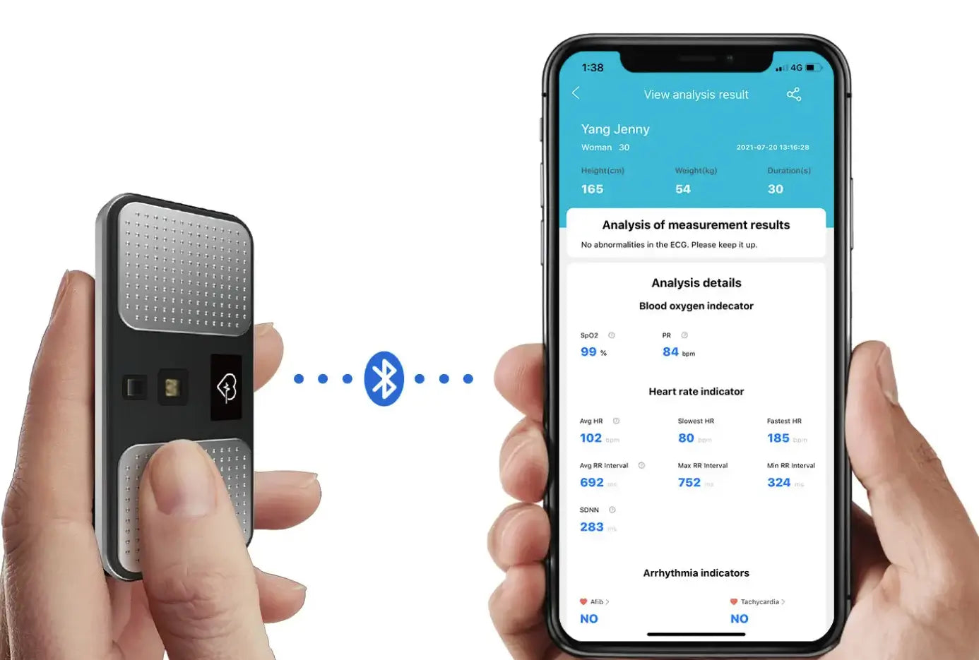 Conexión Bluetooth del monitor ECG ChoiceMMed MD100C con aplicación de salud