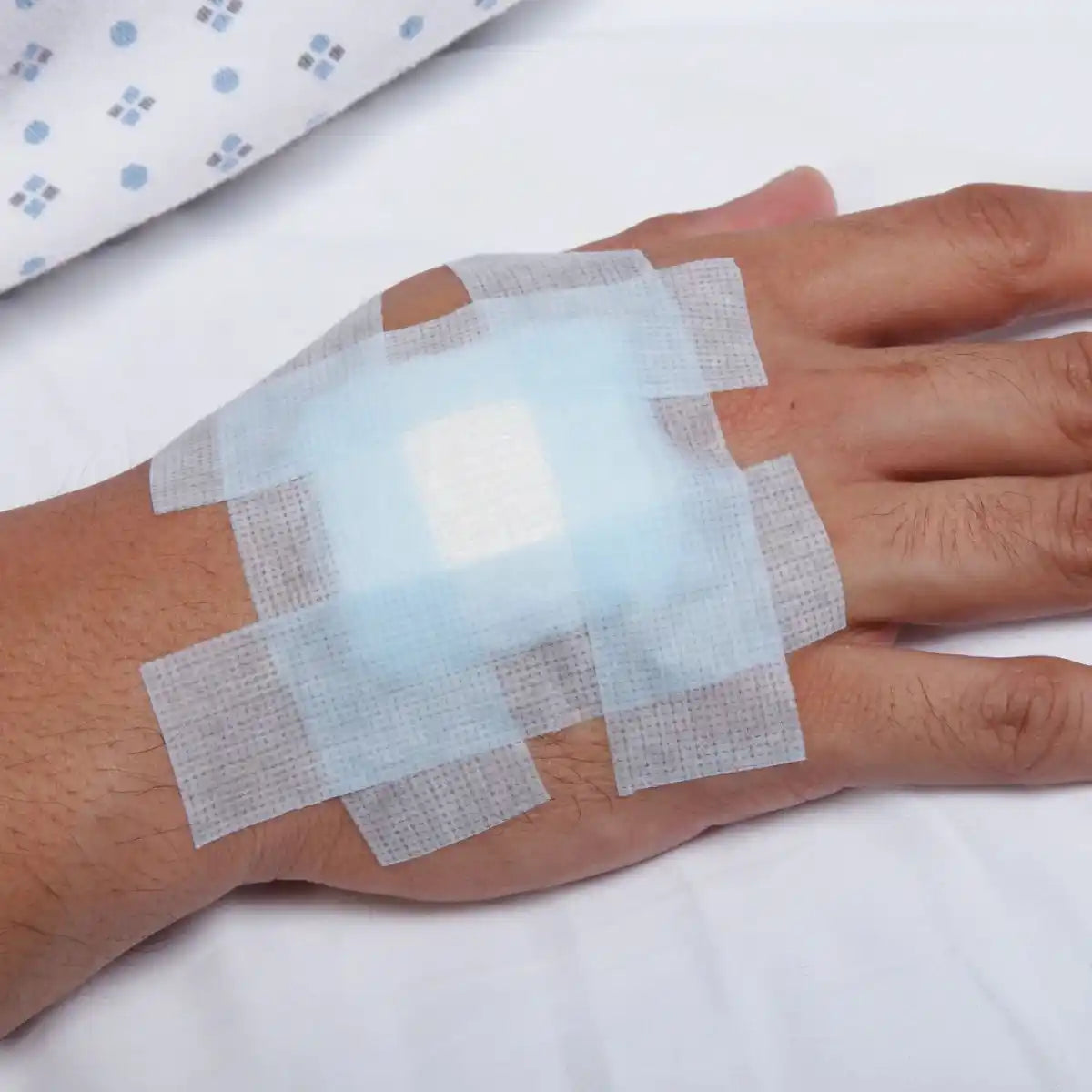 Micropore S 3M fijando apósito en dorso de mano — cinta silicona piel sensible uso clínico
