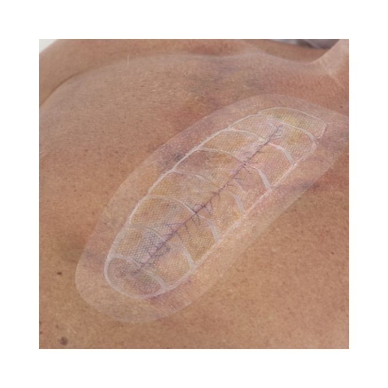 apositos para heridas tegaderm